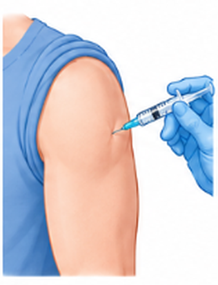 Intramuscular injection into the upper arm